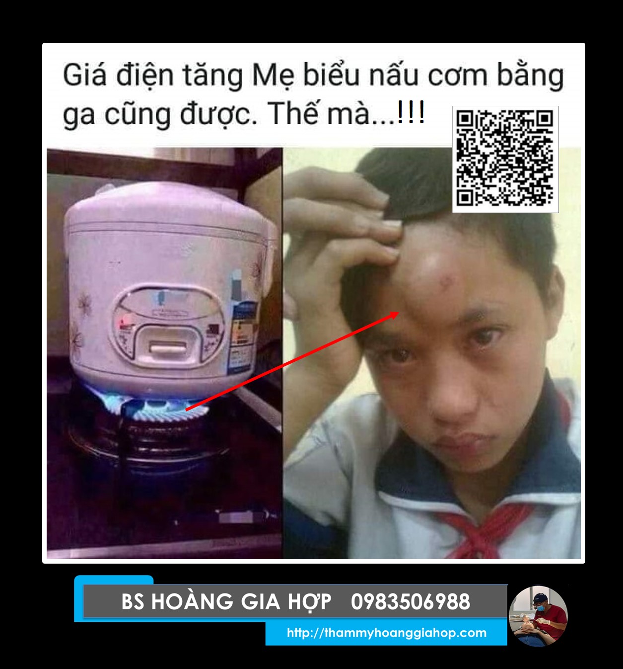 SỐ KHỔ ...???