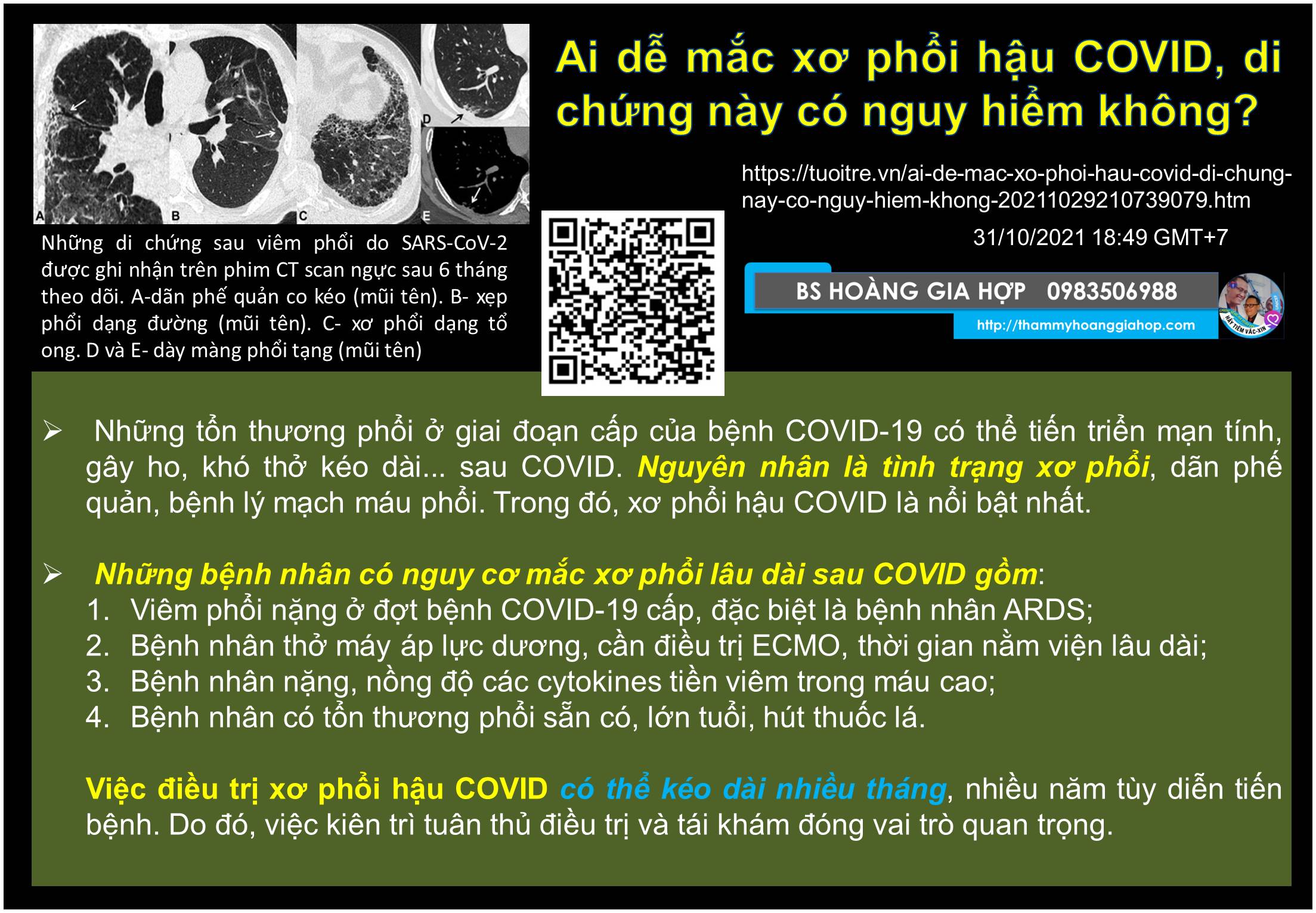 Ai dễ mắc xơ phổi hậu COVID, di chứng này có nguy hiểm không???